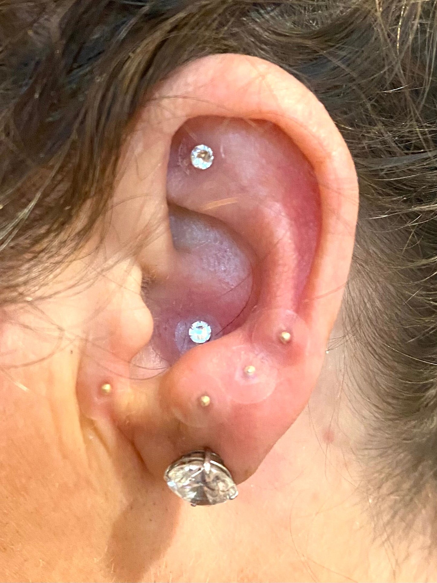 24kt EAR SEEDS| Auriculotherapy| Acupressure| Acupuncture| Nerve endings| Chronic Pain Treatment
